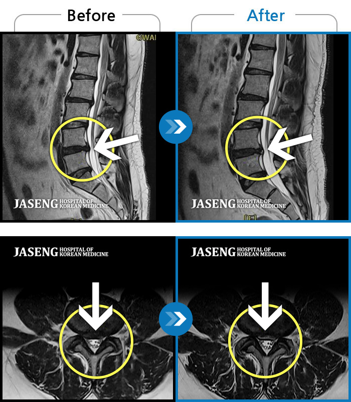 ڻѹ溴 ġ MRI  ġ-㸮        ӵǾ ϼ̽ϴ.