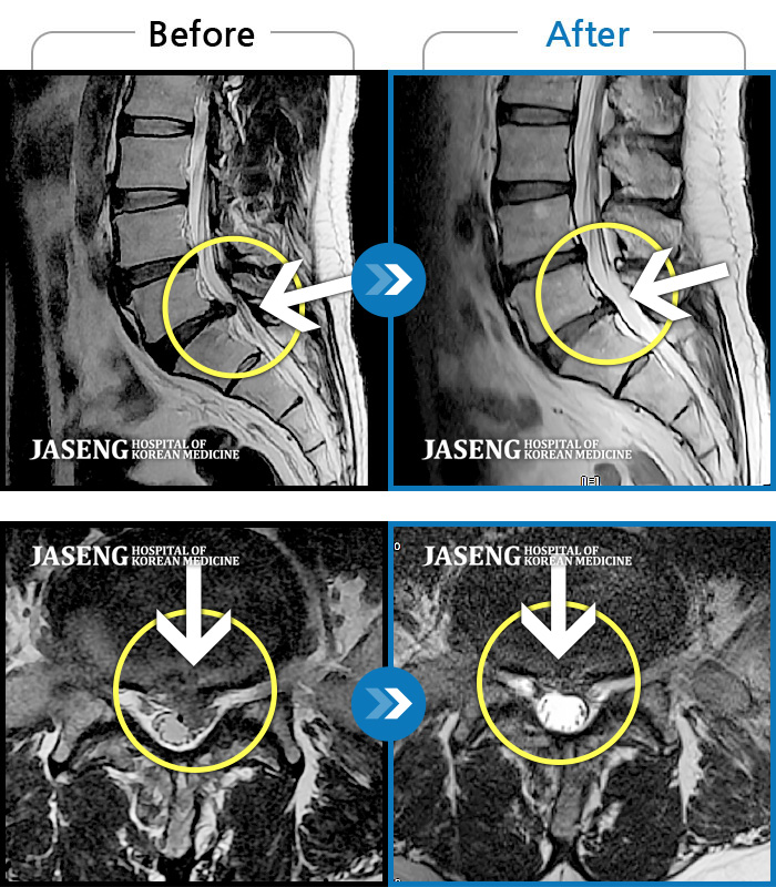 ڻǿ ġ MRI  ġ- ڼ   ġ, , Ƹ ĸ, , ߰   . 