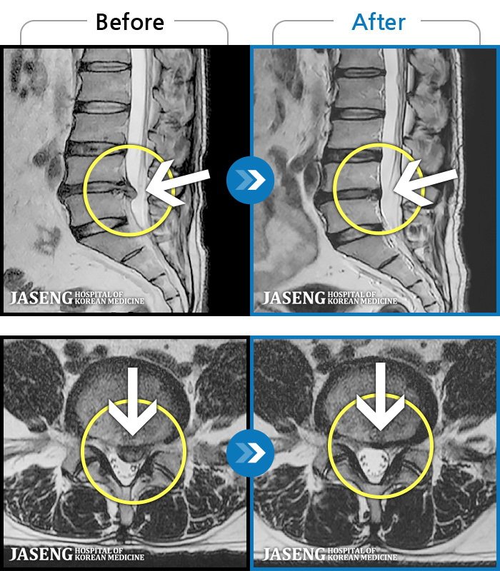 ڻѹ溴 ġ MRI  ġ-  ߰ Ż          ϻ Ȱ ϴ.