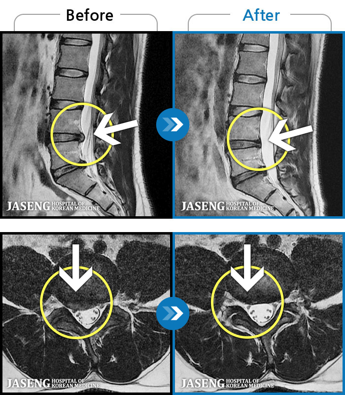 λڻѹ溴 ġ MRI ġ- 㸮 㸮 ̸ ִ.