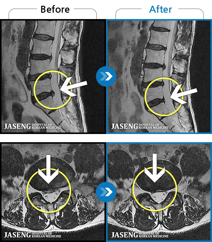 ϻڻѹ溴 ġ MRI  ġ-   ϰ     ӵǾϴ. ߰ Ͽ ߰   Ǵ  ߵ ̻  ȣϴ ¿ϴ.