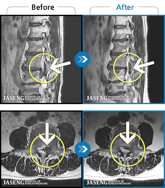 ڻѹ溴 ġ MRI  ġ-㸮      Ͽ ϻȰ  ¿ϴ.