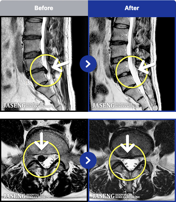 ڻѹ溴 ġ MRI ġ-㸮 Ƹ ٱ ̻ϰ, ٸ