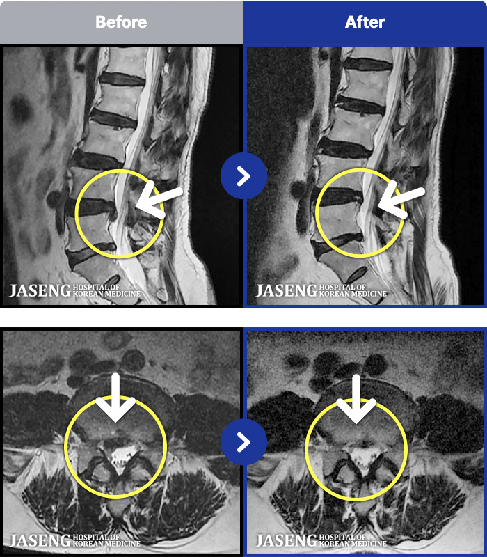 ؿڻѹ溴 ġ MRI ġ-ؽ ϻȰ Ұ · ϼ̽ϴ.