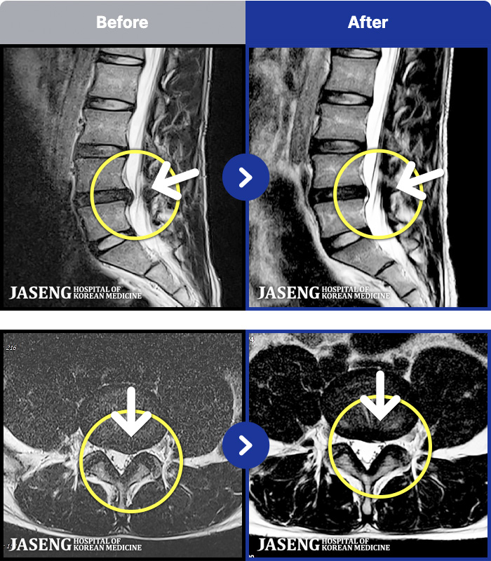 õڻѹ溴 ġ MRI ġ-㸮 ħ 㸮 ߴ.