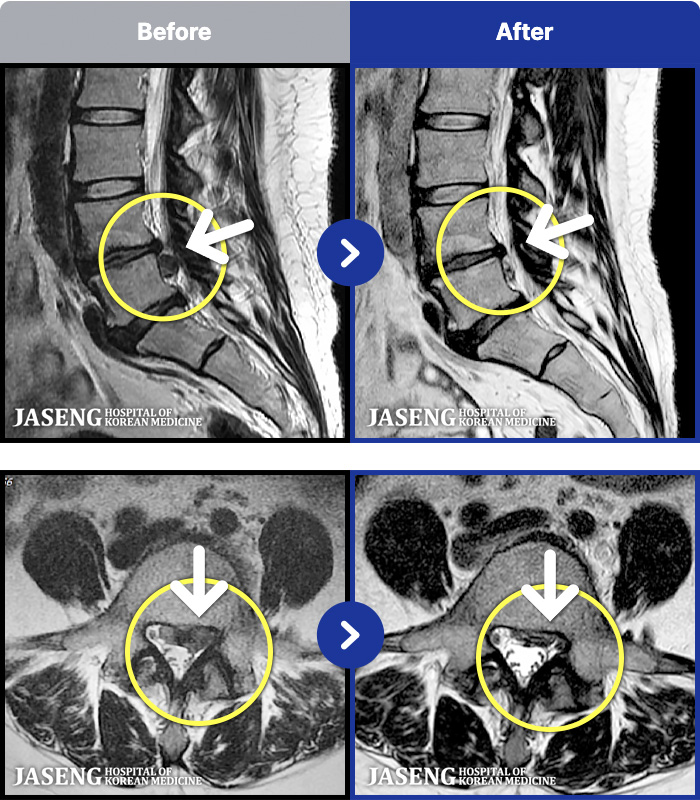 õڻѹ溴 ġ MRI ġ-ؽ 㸮 ߰ ٷ