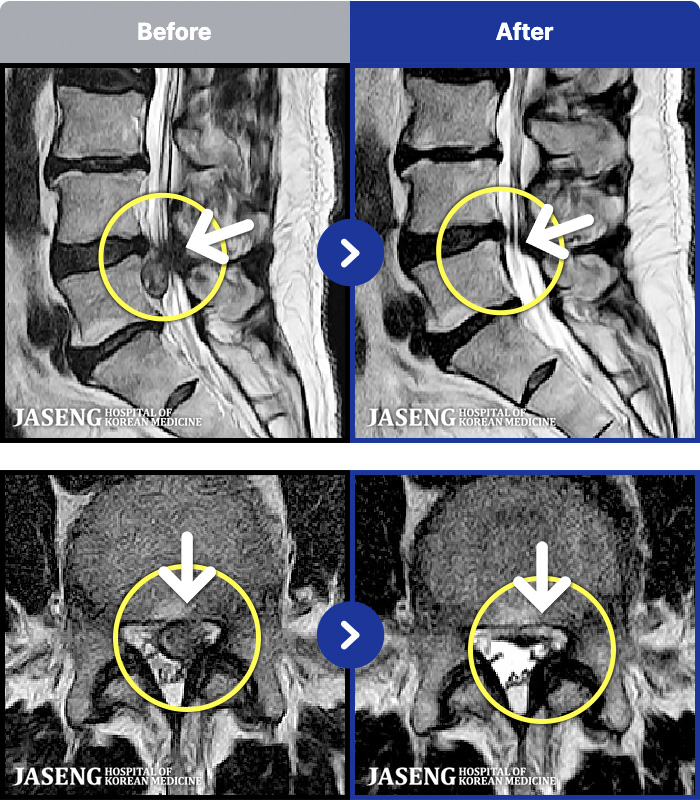 õڻѹ溴 ġ MRI ġ-㸮 ؽϰ ٸ ؼ ߹ٴڱ