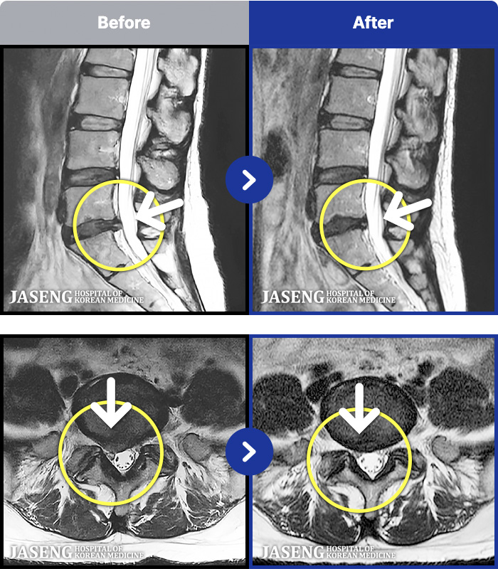 ڻѹ溴 ġ MRI ġ- ٸ ¥ ̸ ɾ.