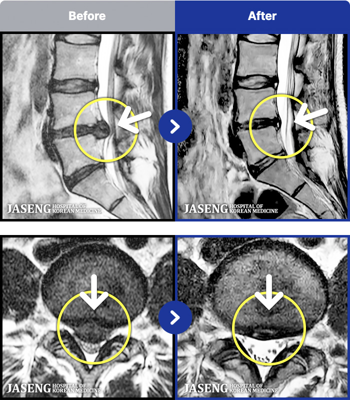 ڻѹ溴 ġ MRI ġ- Ϻ ߿ Ͽ, ٸ ٱ Ƹ ݵǾϴ.