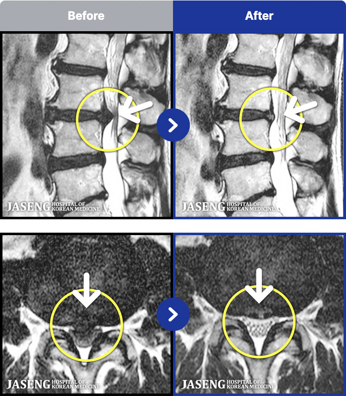 ڻѹ溴 ġ MRI ġ- ġ , Ư ߰ ָ ϴ.