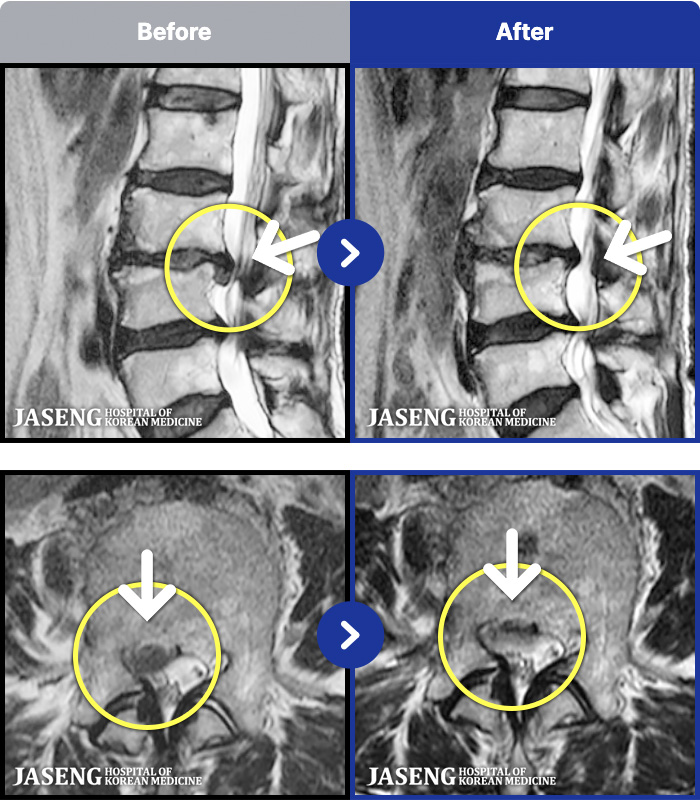 ڻѹ溴 ġ MRI ġ-ϻȰ 㸮 ٸ