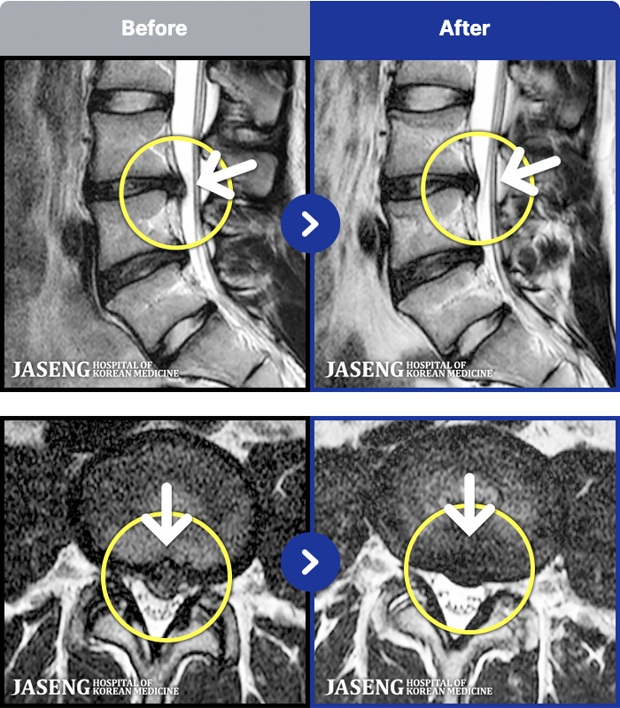 ڻѹ溴 ġ MRI ġ-ð ɾ ִ Ȱ ϴ 