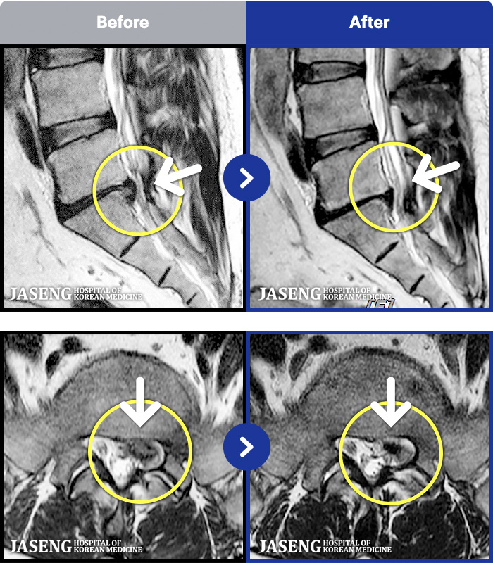 ڻѹ溴 ġ MRI ġ- ũ Ͽϴ.