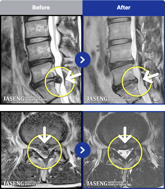 ڻѹ溴 ġ MRI ġ- 㸮