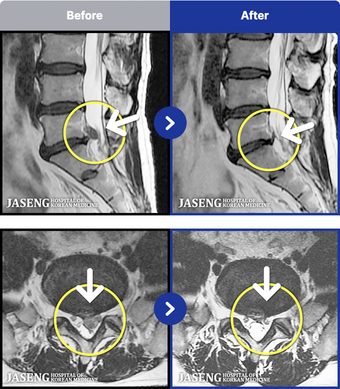 ڻѹ溴 ġ MRI ġ-㸮 Բ ٸ ȱⰡ .