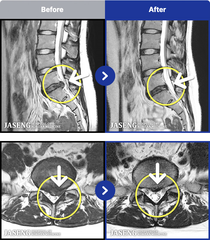 �����ڻ����ǿ� ġ���� MRI�� ���� ġ����-����� ���� ���� �������� ������ ��������ϴ�.