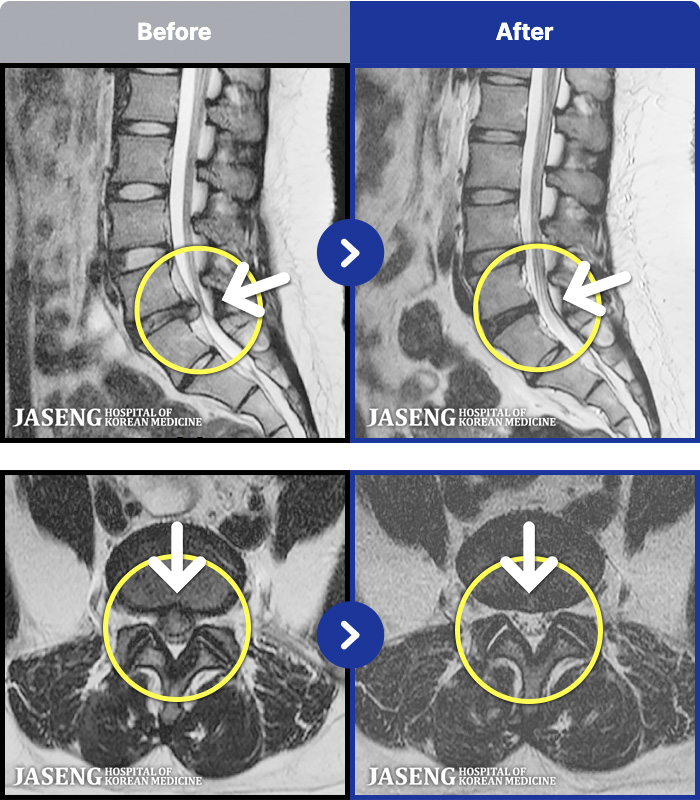 �����ڻ����ǿ� ġ���� MRI�� ���� ġ����-���� �� ���� ��������� ȣ���Ͽ� ���� �� ���������� ��ũ�� ������