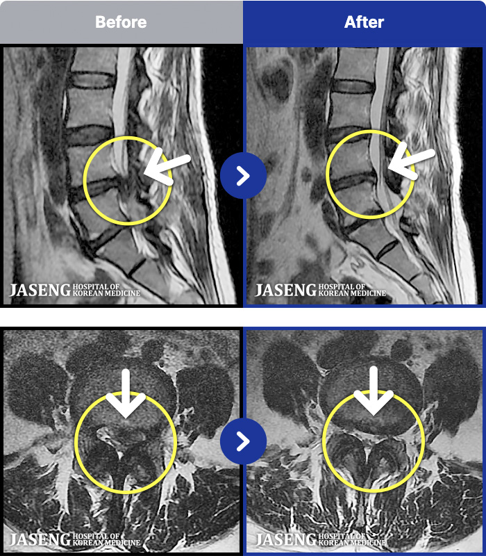 �����ڻ����ǿ� ġ���� MRI�� ���� ġ����-�㸮, ���� ��ݺ��� ���� �ٸ��� ���� �� ������ ���ӵǰ�, ���� �ٸ��� ���� ������, ������ ���Ͽ�����, 