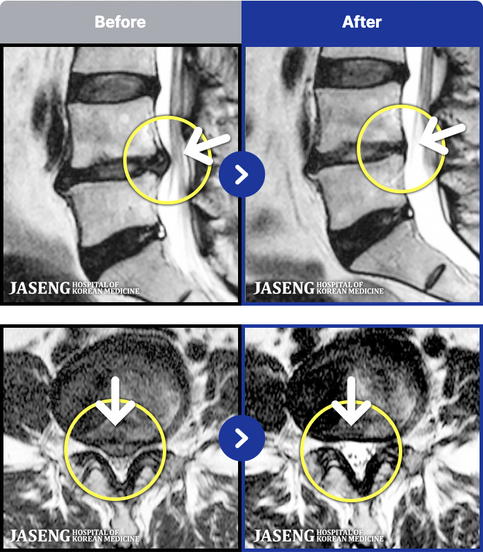 �����ڻ����ǿ� ġ���� MRI�� ���� ġ����-�ؽ��� ����� ���� ���� ��������� ���� ��ð� �ɾ� �ְų� �� �ִ� �ڼ� ������ ����� ���¿���.