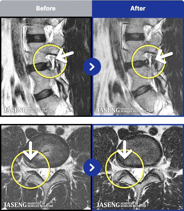 �����ڻ����ǿ� ġ���� MRI�� ���� ġ����-���� �ٸ� ������ �㸮 ������ ���� �ȹٷ� ���� �����, ������ �Բ� �㸮�� ������ �־����� ������ �߻��ߴ�.