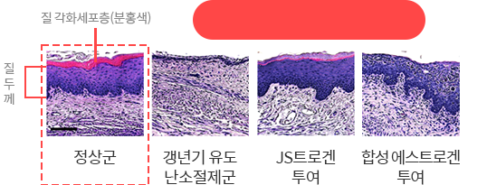 질 각화세포층(분홍색)