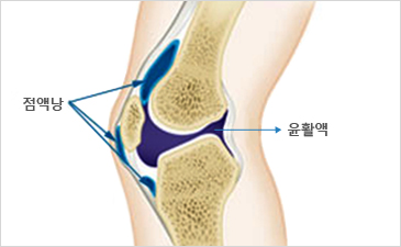 안산자생한방병원 무릎질환 무릎점액낭염-점액낭과 윤활액이 위치해 있는 무릎 설명 이미지