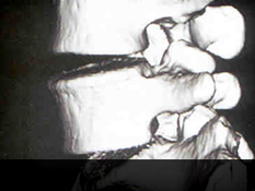 안산자생한방병원 허리질환 퇴행성디스크-정상척추에 관련된 이미지 입니다.