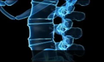 안산자생한방병원 허리질환 척추전방전위증-정상적인 사람의 척추뼈 모습입니다.